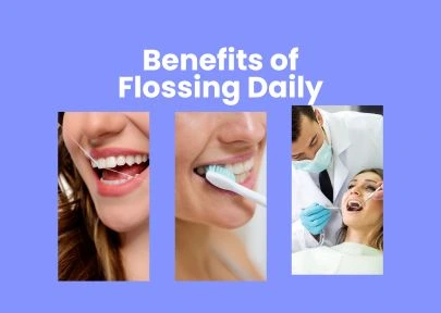 Benefits of Flossing Daily